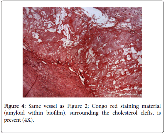 medical-surgical-pathology-staining-material