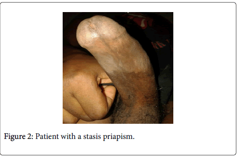 medical-surgical-pathology-stasis-priapism
