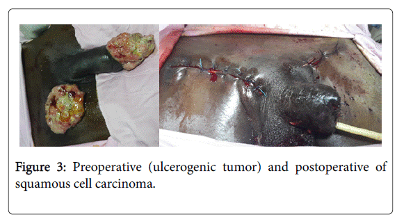 medical-surgical-urology-ulcerogenic-tumor