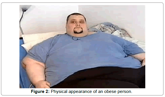 nutrition-food-sciences-obese-person