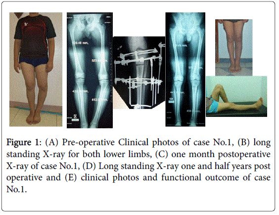 orthopedic-muscular-system-Clinical-photos-lower