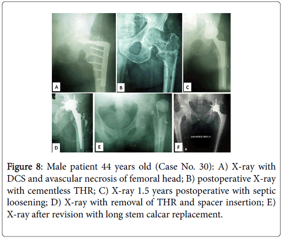 orthopedic-muscular-system-Male-patient-postoperative-X-ray