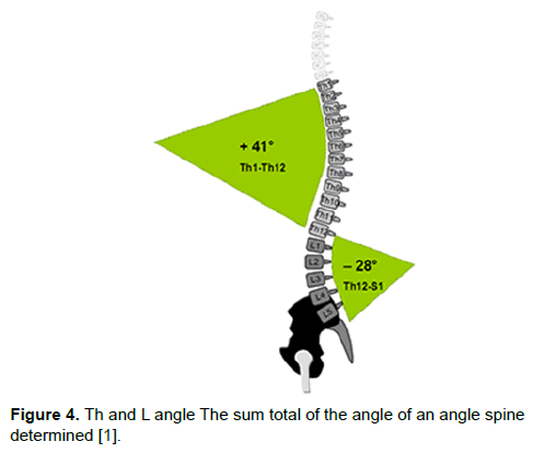 orthopedic-muscular-system-angle-sum-spine