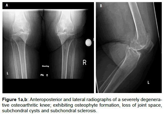 orthopedic-muscular-system-anteroposterior-lateral-radiographs