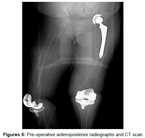 orthopedic-muscular-system-anteroposterior-radiographs-scan