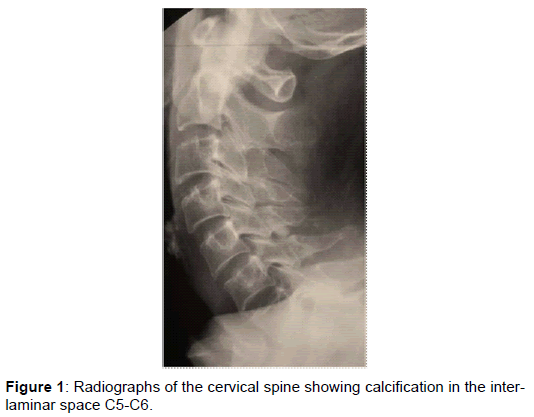 orthopedic-muscular-system-cervical-spine-calcification