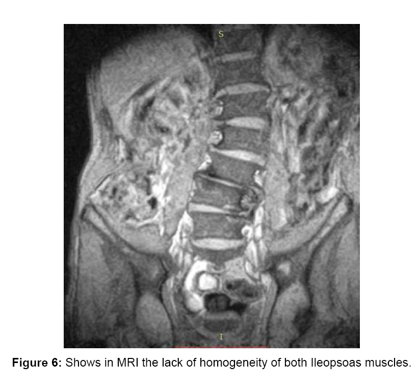 orthopedic-muscular-system-homogeneity