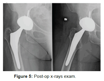 orthopedic-muscular-system-post-op-x-rays-exam