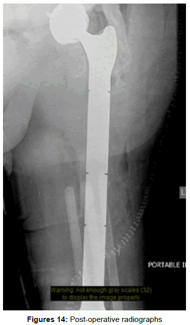 orthopedic-muscular-system-post-operative-radiographs