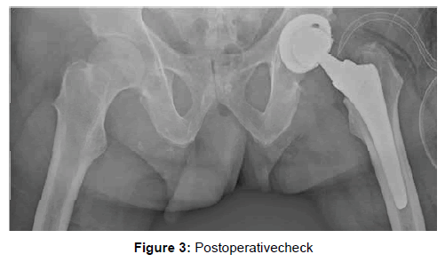 orthopedic-muscular-system-postoperativecheck