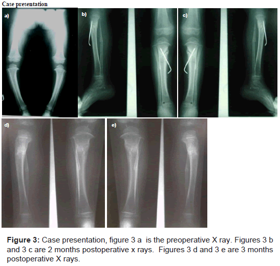 Orthopedic Muscular System Preoperative