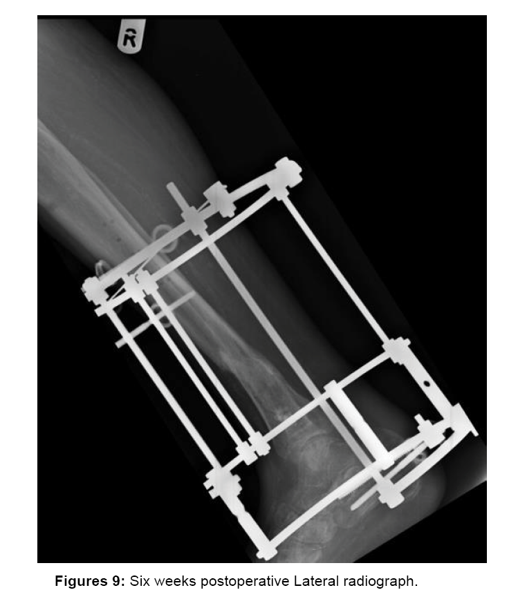 orthopedic-muscular-system-radiograph