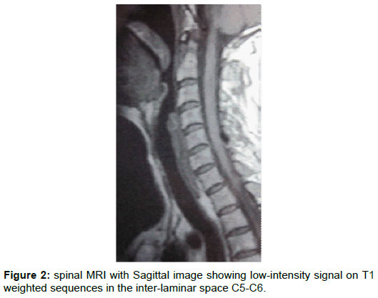 orthopedic-muscular-system-spinal-sagittal-intensity