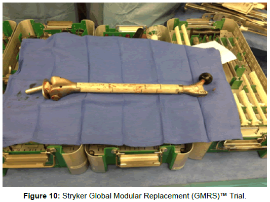orthopedic-muscular-system-stryker-global-modular
