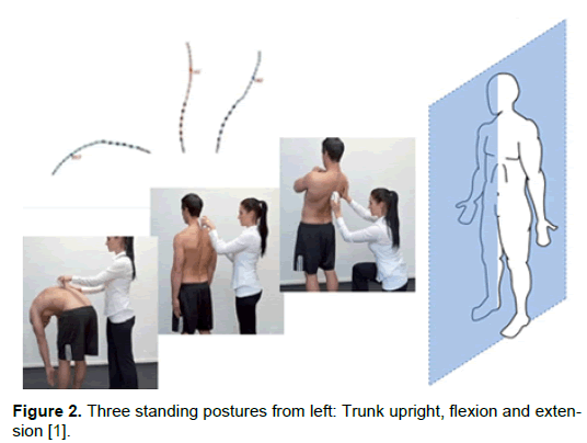 orthopedic-muscular-system-three-standing-postures