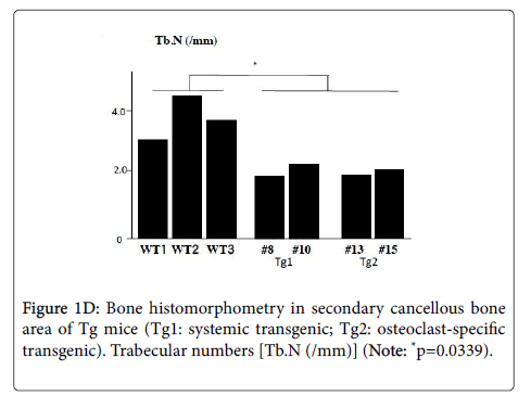 osteoporosis-and-physical-activity-Osteoblast-surfaces