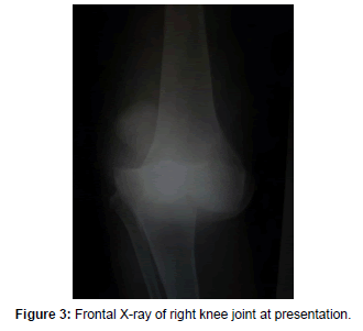 neonatal-biology-potential-cytoskeletal-knee-joint