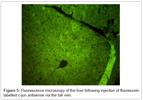 pancreatic-disorders-therapy-Fluorescence-microscopy