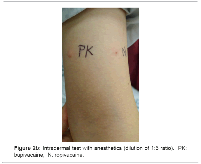 pediatrics-therapeutics-Intradermal