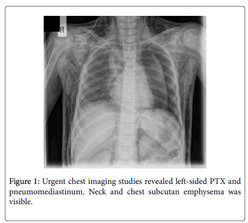 pediatrics-therapeutics-chest