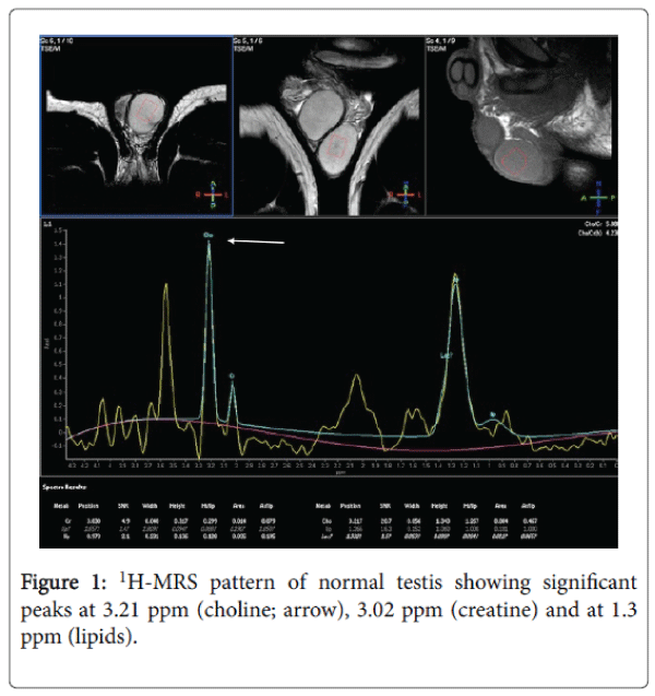 reproductive-system-sexual-disorders-testis-showing-significant-peaks