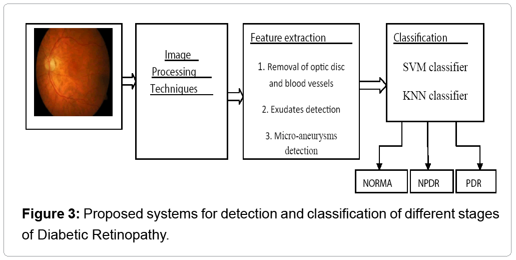 diabetic retinopathy research paper