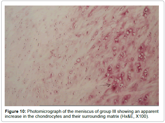 rheumatology-current-chondrocytes-matrix