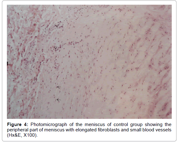 rheumatology-current-fibroblasts-blood