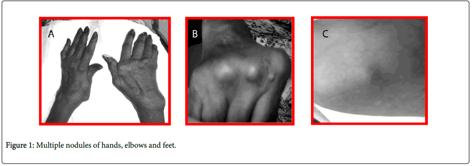 rheumatology-current-hands-elbows-feet