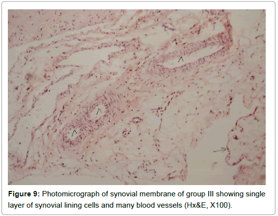 rheumatology-current-layer-blood-vessels