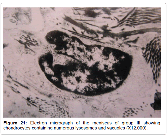 rheumatology-current-micrograph