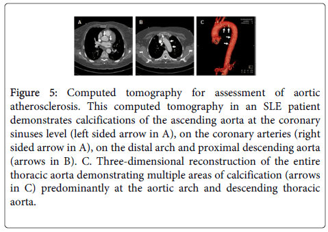rheumatology-current-tomography-coronary