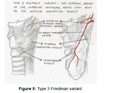 Surgical anatomy of the external branch of the superior laryngeal