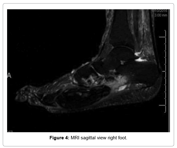 tumor-diagnostics-reports-MRI-sagittal