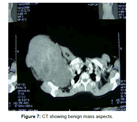 tumor-diagnostics-reports-mass-aspects