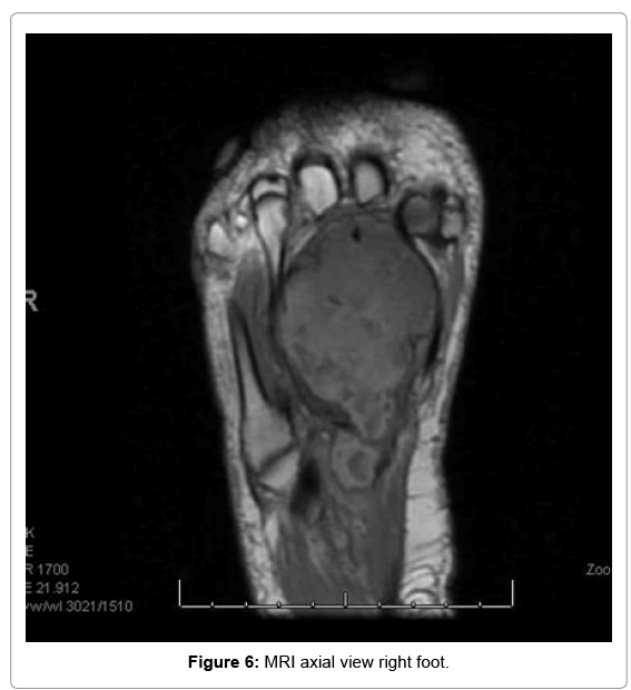 tumor-diagnostics-reports-right-foot